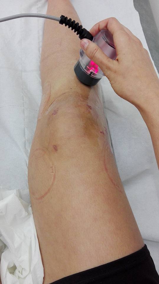         Ultrasonido (10 minutos/día)