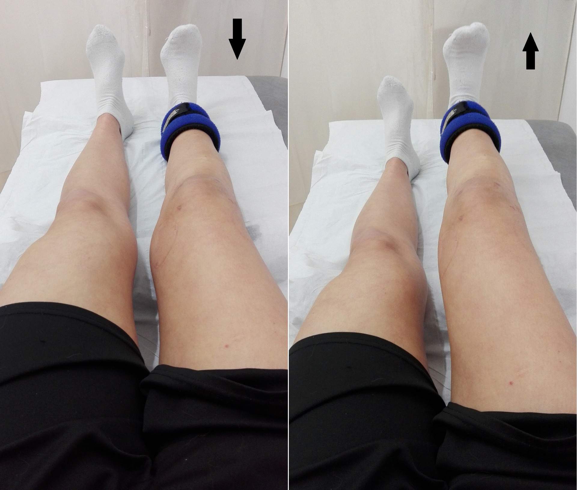 Ejercicios isométricos. Aguantamos 5-6 segundos en el aire, bajamos la pierna y la volvemos a subir. Así constantemente, hasta hacer 30 repeticiones de cada ejercicio.