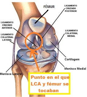 En el punto de contacto (círculo) es donde han quitado el trozo de fémur.